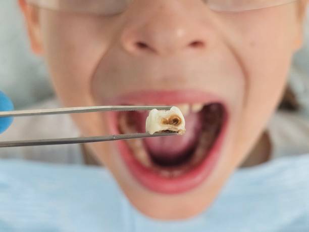 Best Emergency Dental Services for Seniors in Toledo, IA